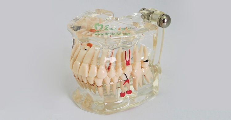 TM-C2 StandardTransparent